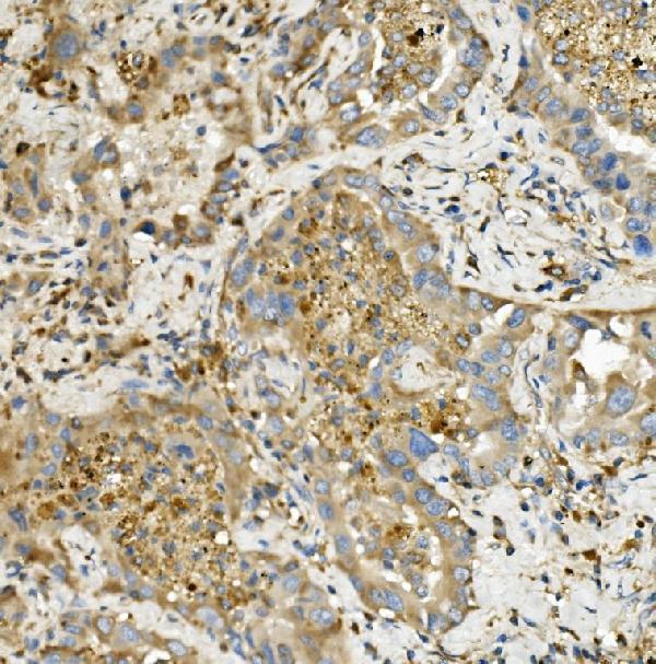  IHC analysis of Hexokinase 1/HK1 using anti-Hexokinase 1/HK1 antibody (M01504-1)