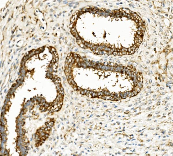  IHC analysis of Hexokinase 1/HK1 using anti-Hexokinase 1/HK1 antibody (M01504-1)