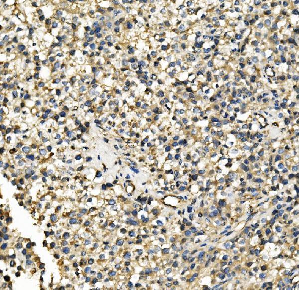 m01504 1 hk1 primary antibodies ihc testing 4