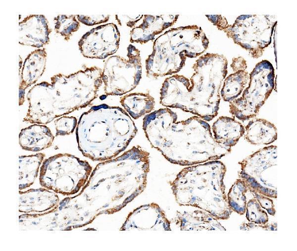 m01504 1 hk1 primary antibodies ihc testing 5