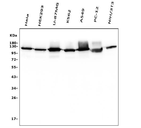  Western blot analysis of Hexokinase 1/HK1 using anti-Hexokinase 1/HK1 antibody (M01504-1)