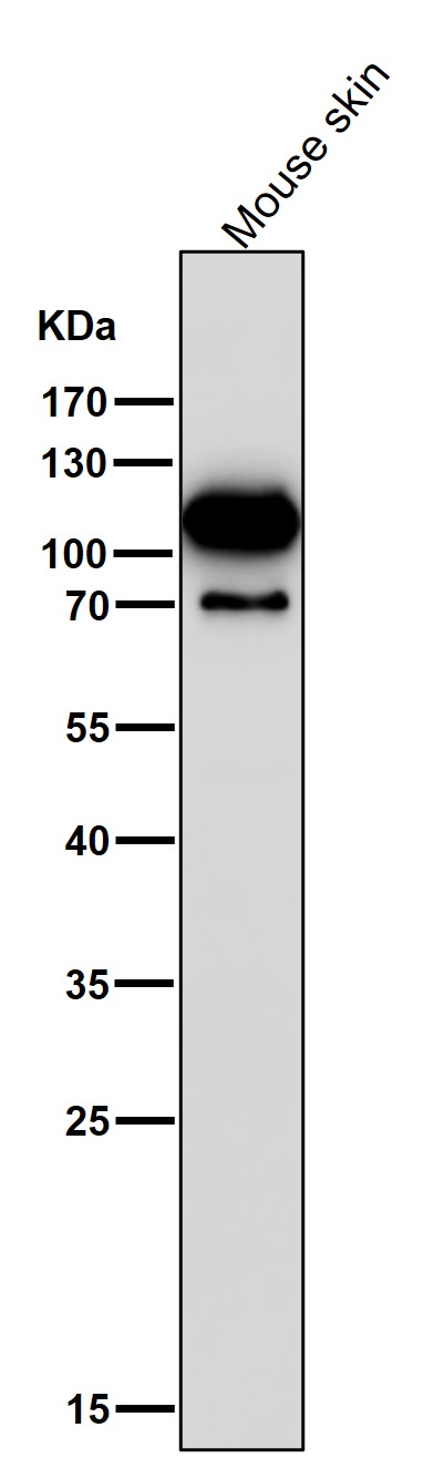 All lanes use the Antibody at 1:1W dilution for 1 hour at room temperature