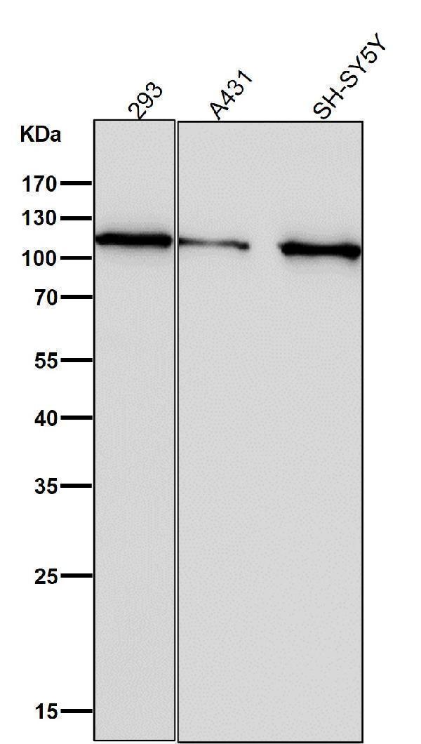 All lanes use the Antibody at 1:1W dilution for 1 hour at room temperature