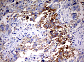 m01506 1 anti hmbs mouse monoclonal antibody clone id oti3f4 ihc testing 2