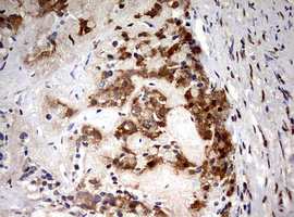 m01506 1 anti hmbs mouse monoclonal antibody clone id oti3f4 ihc testing 3