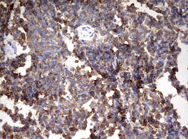 m01506 1 anti hmbs mouse monoclonal antibody clone id oti3f4 ihc testing 4