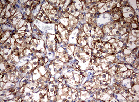 m01506 1 anti hmbs mouse monoclonal antibody clone id oti3f4 ihc testing 6