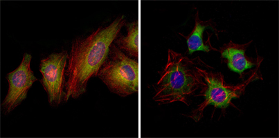 Immunofluorescence analysis of Hela (left) and HepG2 (right) cells using EphB2 Monoclonal Antibody (green)