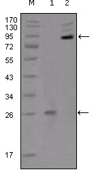 Western Blot analysis using EphB2 Monoclonal Antibody against truncated EphB2 recombinant protein (1) and extracellular EphB2 (aa19-476)-hIgGFc transfected CHO-K1 cell lysate (2)