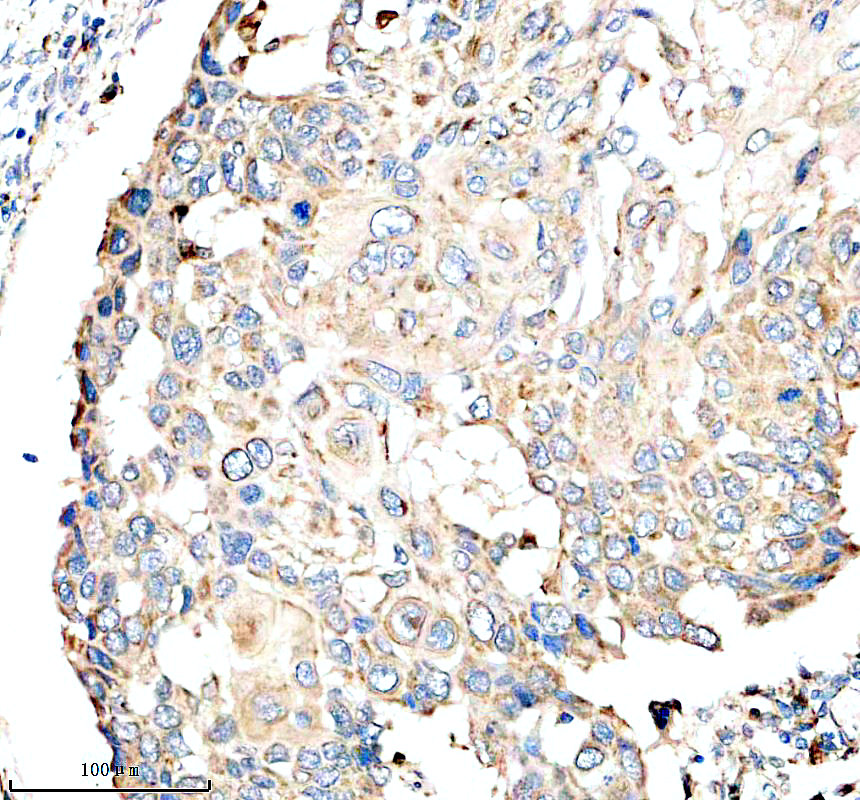 IHC analysis of CTSH using anti-CTSH antibody (M01510)