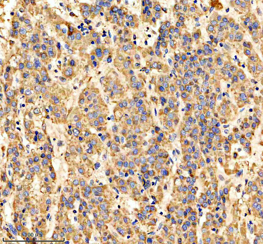 IHC analysis of CTSH using anti-CTSH antibody (M01510)