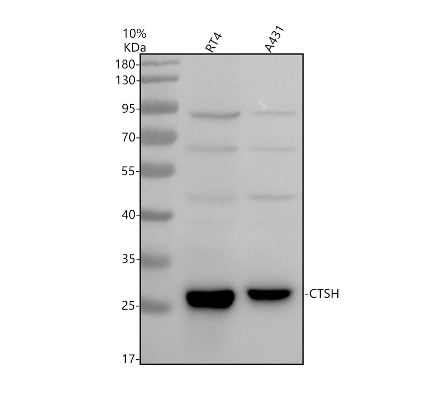 Western blot analysis of CTSH using anti-CTSH antibody (M01510)