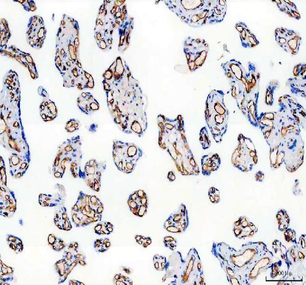 IHC analysis of CD31 using anti-CD31 antibody (M01513-1)
