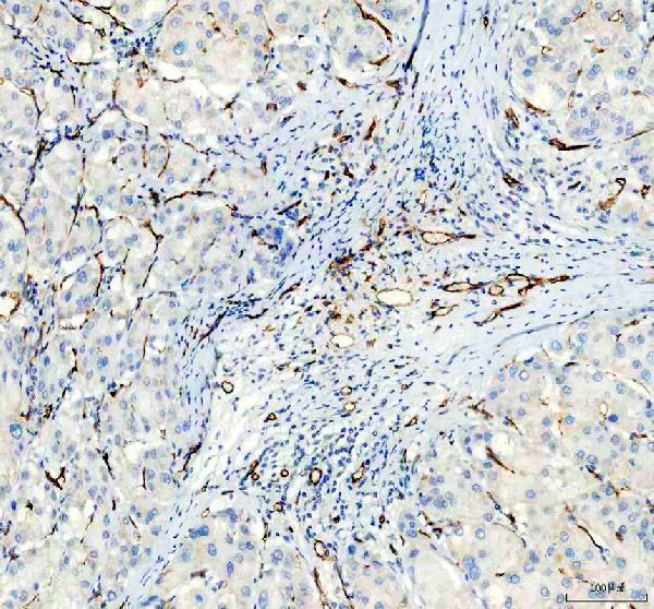 IHC analysis of CD31 using anti-CD31 antibody (M01513-1)
