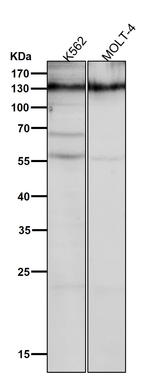 All lanes use the Antibody at 1:5K dilution for 1 hour at room temperature