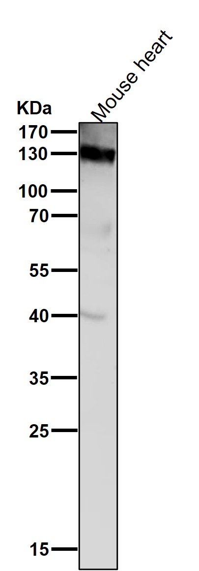 All lanes use the Antibody at 1:5K dilution for 1 hour at room temperature