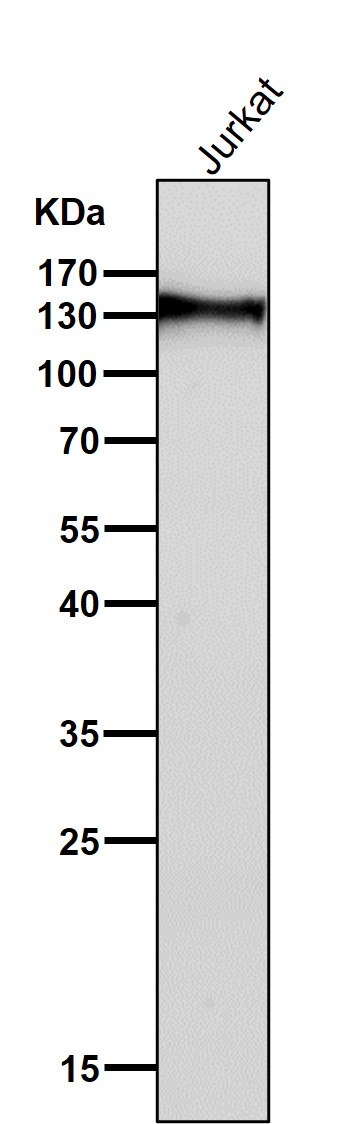 All lanes use the Antibody at 1:5K dilution for 1 hour at room temperature