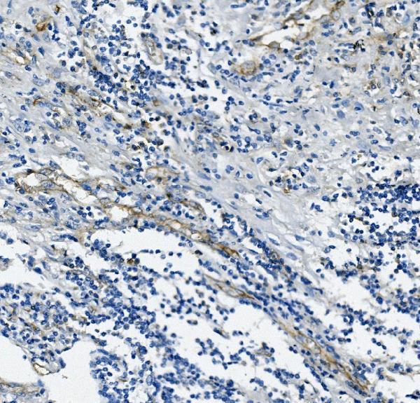  IHC analysis of CD31/PECAM1 using anti-CD31/PECAM1 antibody (M01513-4)