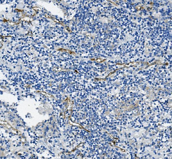  IHC analysis of CD31/PECAM1 using anti-CD31/PECAM1 antibody (M01513-4)