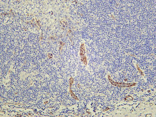 Human tonsil was stained with Anti-CD31 rabbit antibody