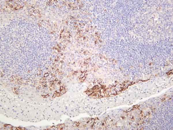 Human tonsil was stained with anti-CD31 rabbit antibody