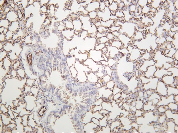 Mouse lung was stained with anti-CD31 rabbit antibody