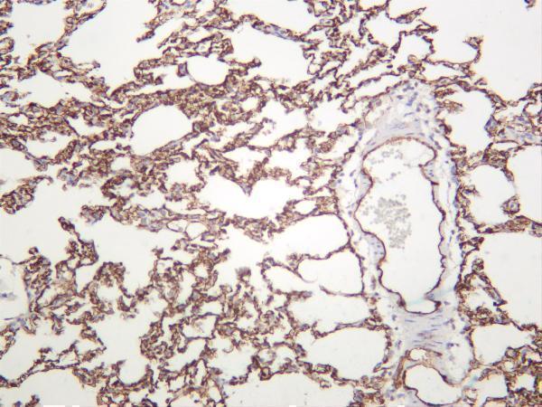 Rat lung was stained with anti-CD31 rabbit antibody