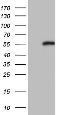 HEK293T cells were transfected with the pCMV6-ENTRY control (Left lane) or pCMV6-ENTRY NR0B1 (Right lane) cDNA for 48 hrs and lysed