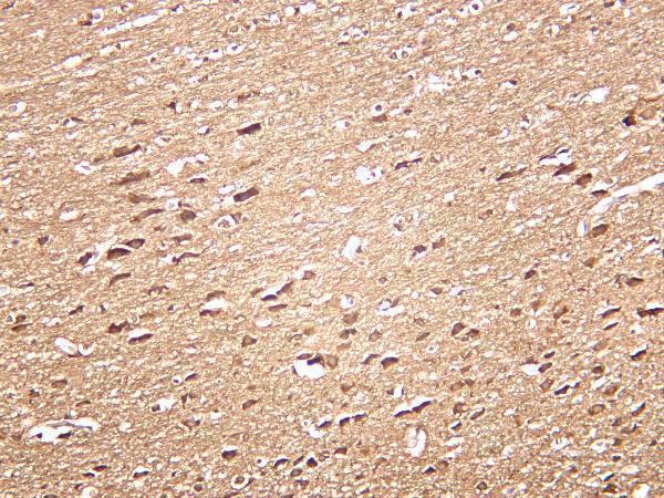 Rat brain was stained with anti-LC3B rabbit antibody