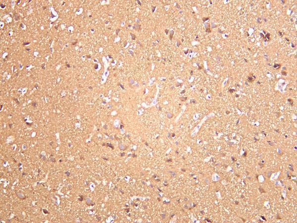 Human brain was stained with anti-LC3B rabbit antibody