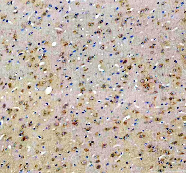 m01524 lc3b primary antibodies ihc testing 2