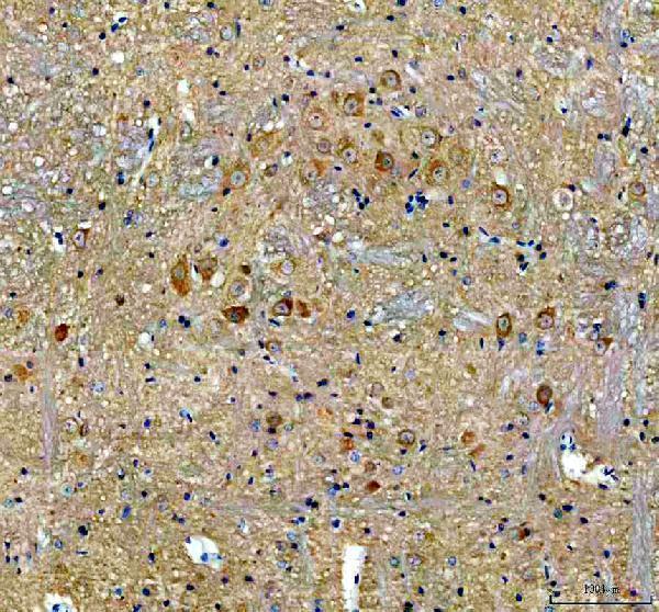 m01524 lc3b primary antibodies ihc testing 3