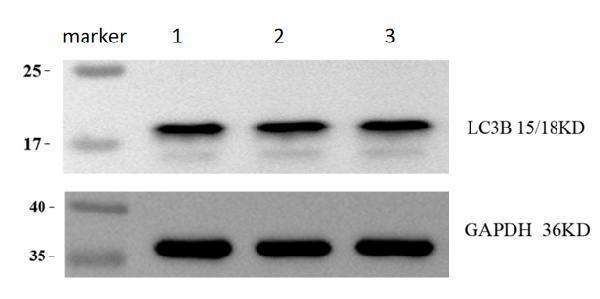 m01524 lc3b primary antibodies wb review 1