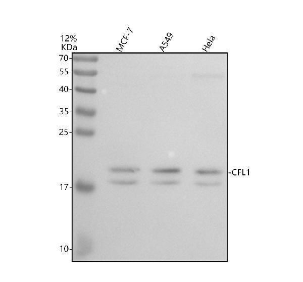 Western blot analysis of Cofilin/CFL1 using anti-Cofilin/CFL1 antibody (M01525)