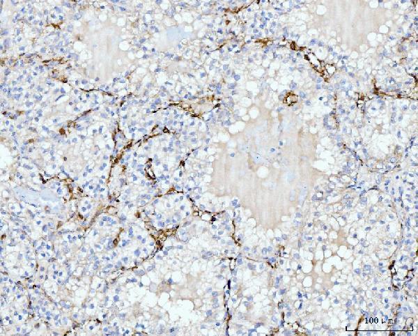 IHC analysis of FABP4 using anti-FABP4 antibody (M01528-2)