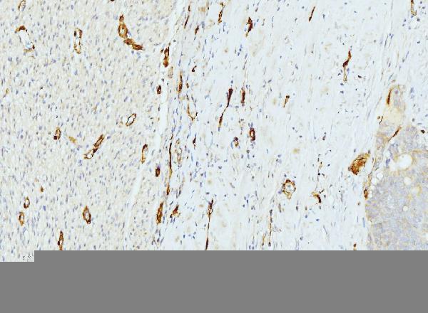  IHC analysis of FABP4 using anti-FABP4 antibody (M01528-2)