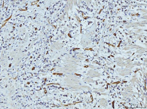 m01528 2 fabp4 primary antibodies ihc testing 4