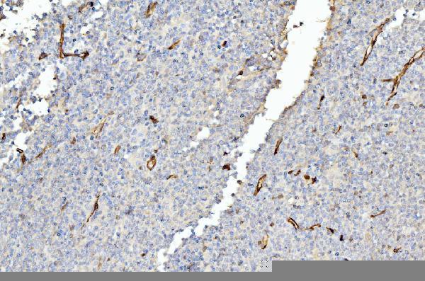m01528 2 fabp4 primary antibodies ihc testing 5