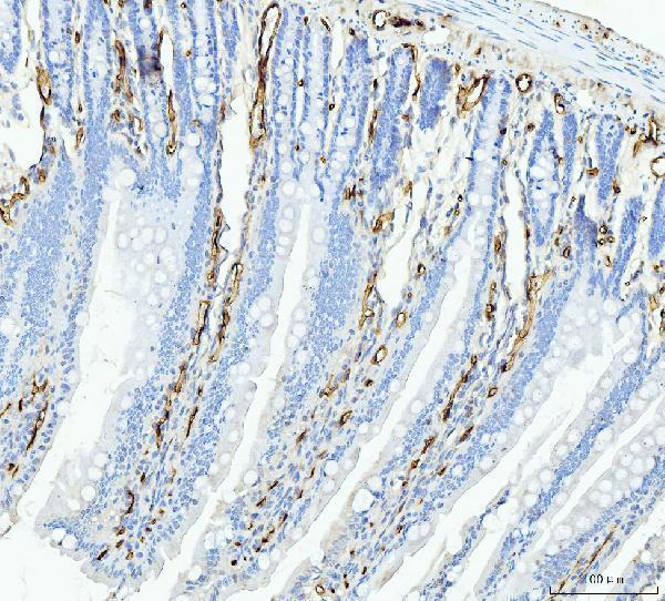 m01528 2 fabp4 primary antibodies ihc testing 6