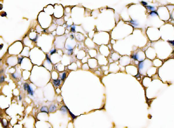m01528 2 fabp4 primary antibodies ihc testing 7