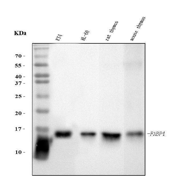  Western blot analysis of FABP4 using anti-FABP4 antibody (M01528-2)