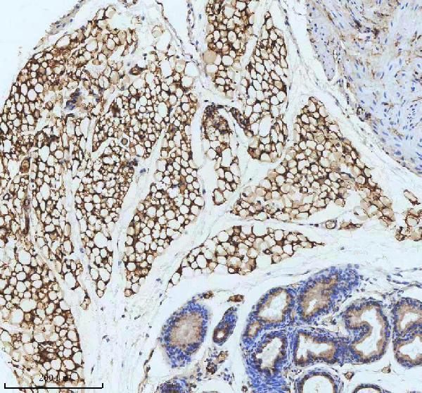 m01528 fabp4 primary antibodies ihc testing 2