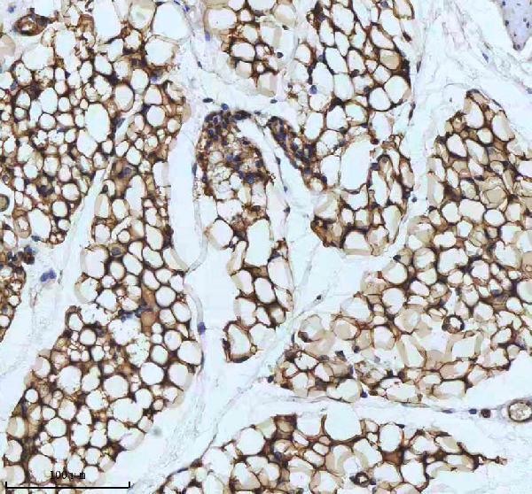 m01528 fabp4 primary antibodies ihc testing 3