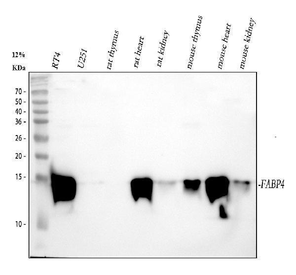 m01528 fabp4 primary antibodies wb testing 1