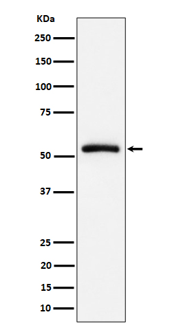 Western blot analysis of CAP1 expression in Raji cell lysate