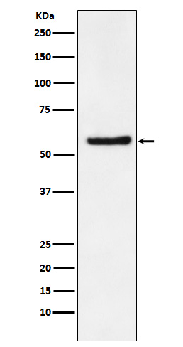 Western blot analysis of DKC1 expression in SW480 cell lysate