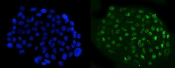  IF analysis of NFIB/NF1B2 using anti-NFIB/NF1B2 antibody (M01537-1)