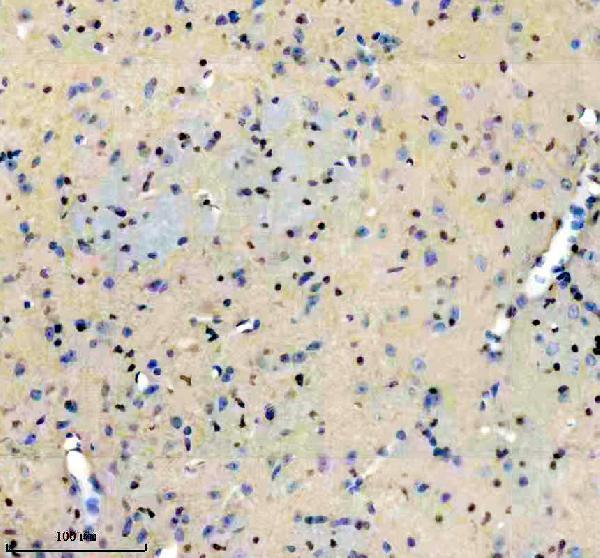 m01537 2 nfib primary antibodies ihc testing 2