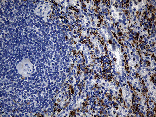 Immunohistochemical staining of paraffin-embedded Human spleen tissue within the normal limits using anti-TLR8 mouse monoclonal antibody