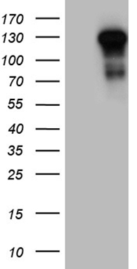 HEK293T cells were transfected with the pCMV6-ENTRY control (Left lane) or pCMV6-ENTRY TLR8 (Right lane) cDNA for 48 hrs and lysed